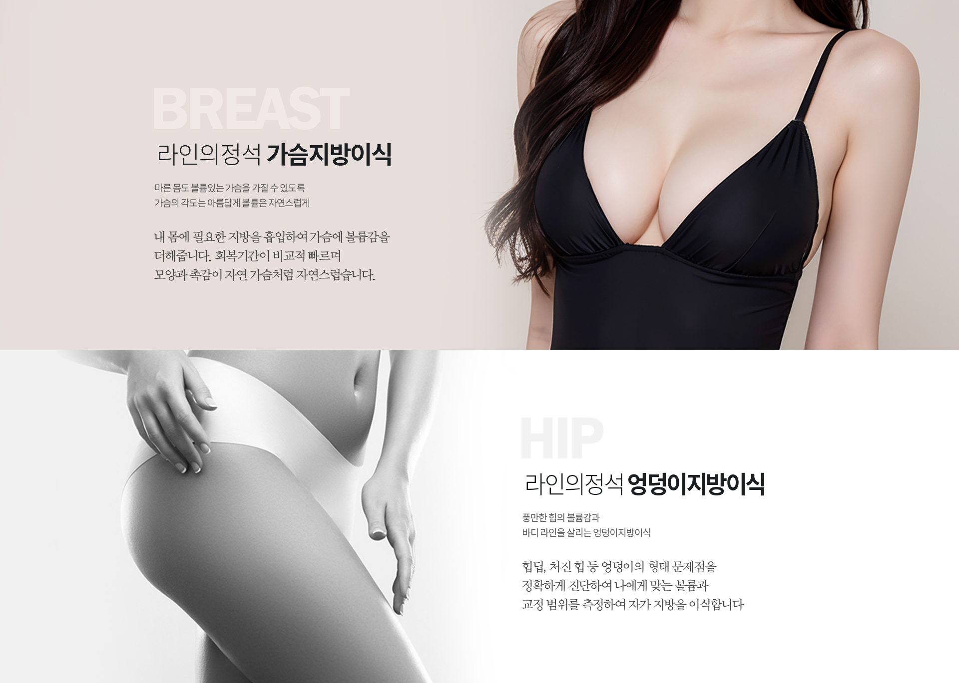 바디지방이식 상세04