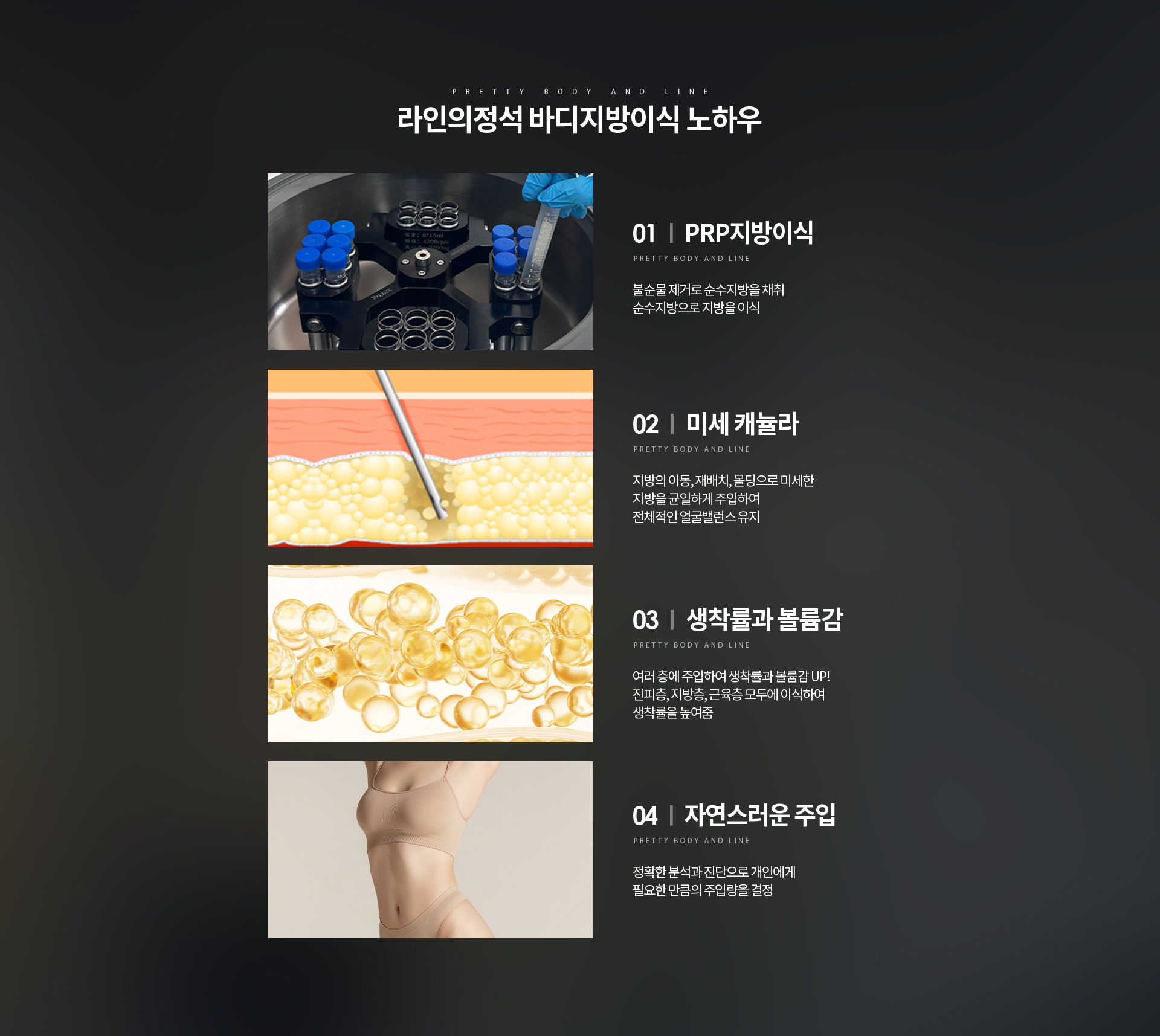 바디지방이식 상세08